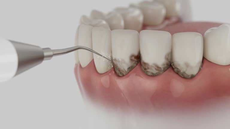 Trusted Dental Crowns And Bridges service in Cresco, IA - Dentist Open Now
